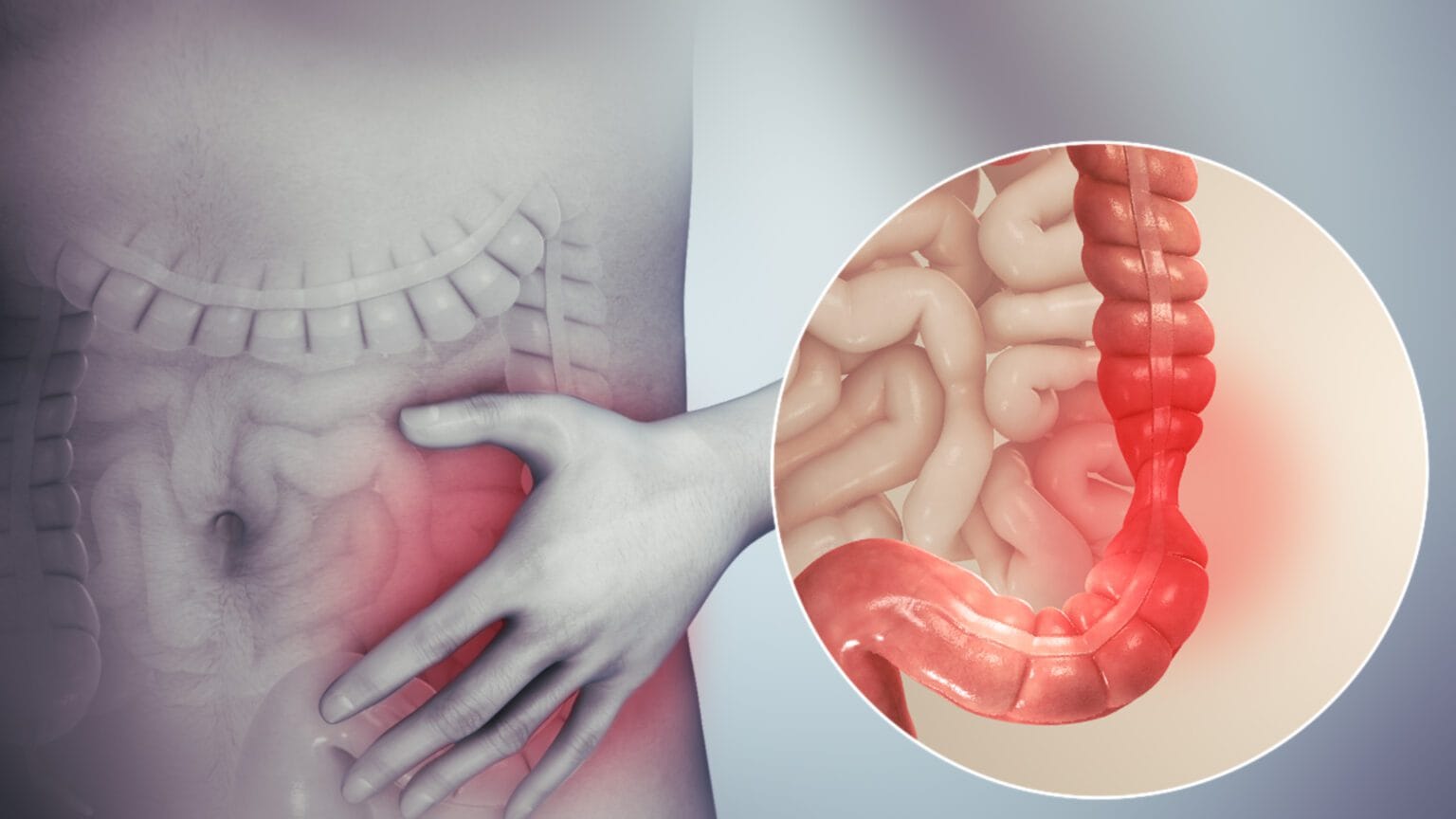 Síndrome do Intestino Irritável: Guia Prático de Autocuidado e Tratamento Integrativo